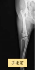手術前