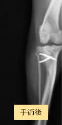 手術後